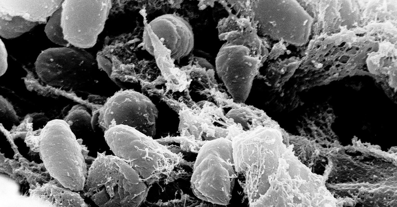 Peste : un enfant aux Etats-Unis attrape la peste bubonique