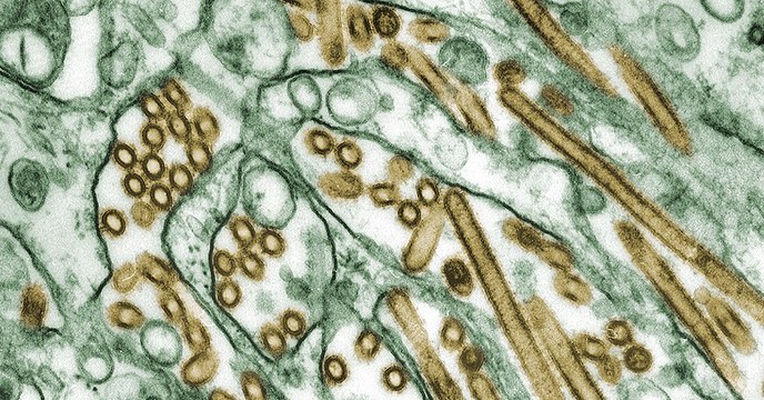 Il y a 100 ans, la grippe espagnole déclenchait l'une des pires épidémies de l'Histoire