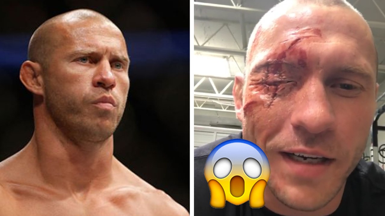 Donald „Cowboy“ Cerrone zeigt seine schreckliche Augenverletzung: Fake oder nicht?