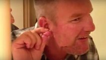 Mann drückt Riesenpickel an seinem Ohr aus: Das Ergebnis schockiert nicht nur ihn