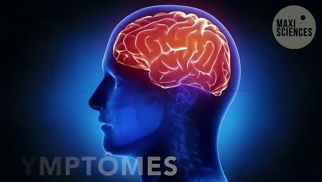 Alzheimer : des parties du cerveau se modifient avant l'arrivée des premiers symptômes