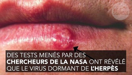 Espace : voilà pourquoi les astronautes sont beaucoup plus touchés par l’herpès