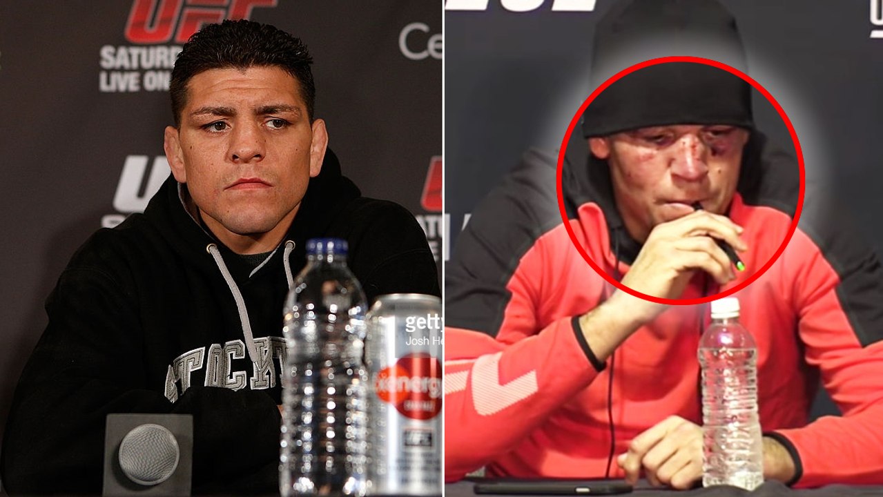 Nick Diaz verrät, was sein Bruder Nate nach dem Rückkampf gegen Conor McGregor geraucht hat