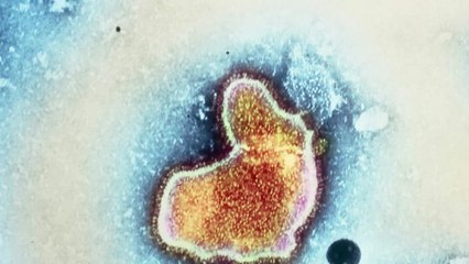 Bronchiolite : cette nouvelle épidémie qui touche la quasi-totalité des régions françaises