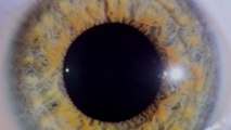Santé : l'étrange cas d'un homme capable de changer la taille de ses pupilles à volonté