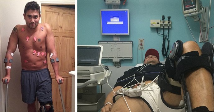 Rav Wilding : blessé pendant l'entraînement de l'émission Splash! , il se retrouve avec une jambe plus courte que l'autre