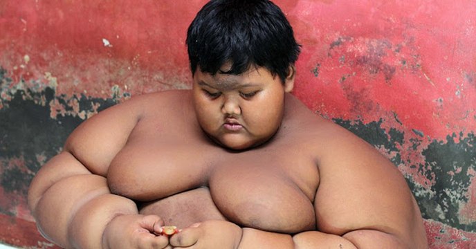 Arya Permana : Le garçon le plus gros du monde retourne à l'école après sa perte de poids