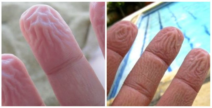 Voilà pourquoi votre peau est toute fripée à la sortie du bain