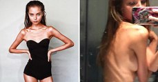Alesya Kafelnikova : traitée d'anorexique par les internautes, elle prouve le contraire avec un bon burger