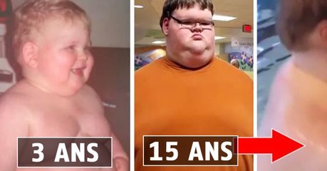 Jacob Miller : cet enfant grossissait de 40kg par an depuis sa naissance. Voici ce qu'il devient