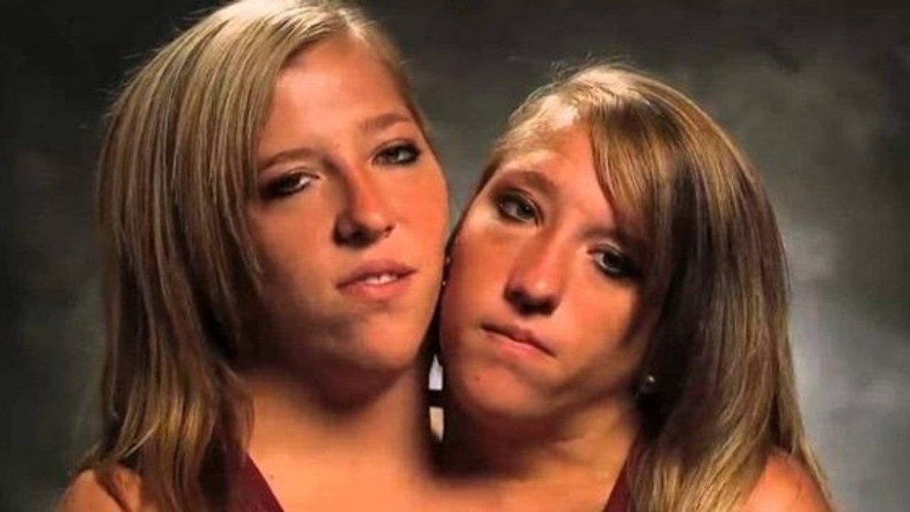 Die siamesischen Zwillinge Abigail und Brittany Hensel konnten ihren größten Wunsch wahr machen