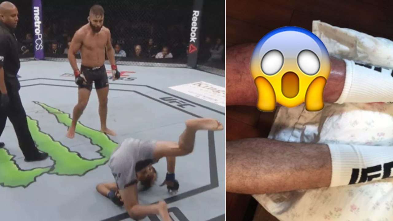 Jeremy Stephens zerstört das Bein von Gilbert Melendez