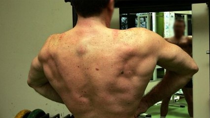 Wegen Kokain und Anabolika: Zwei junge Fitnessfans verhaftet