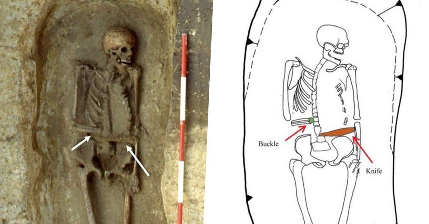 Skelettfund: Mann hatte Messer an amputierter Hand