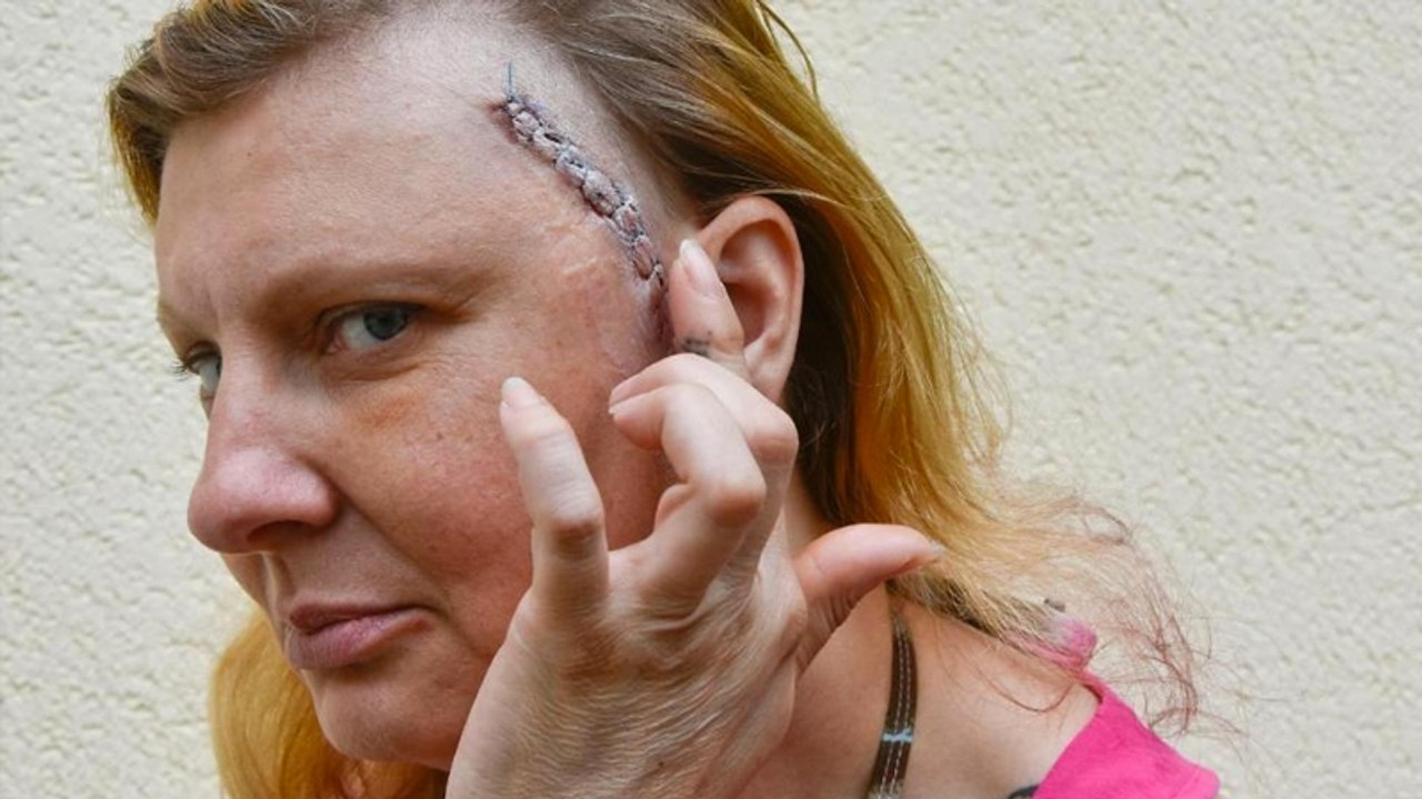 Mann (33) schlägt Frau (44) fast tot: Das Urteil sorgt für Empörung!