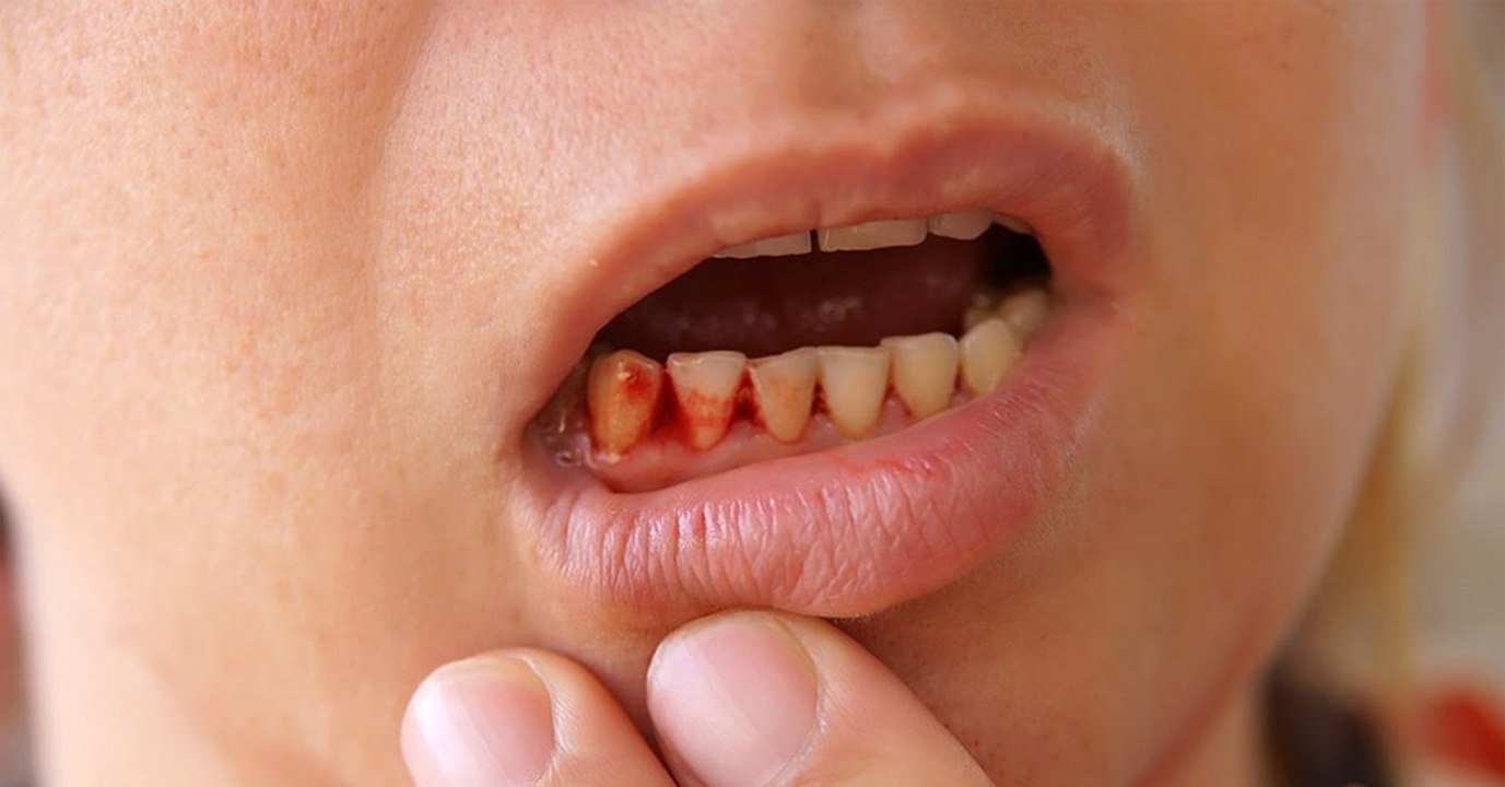 Tödliche Krankheit aus dem 18. Jahrhundert breitet sich in den Industrieländern wieder aus