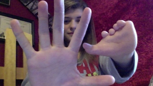 Cette jeune fille est née sans main droite et ne manque pas de courage