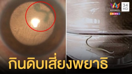 ผวา! เจอพยาธิปอดหนูขึ้นตา สาว ขรก.ตาบอด หมอเตือนกินดิบเสี่ยง | ข่าวเที่ยงอมรินทร์ | 3 ก.พ.65