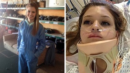 Cette fille est une miraculée. Elle a survécu à un accident terrible