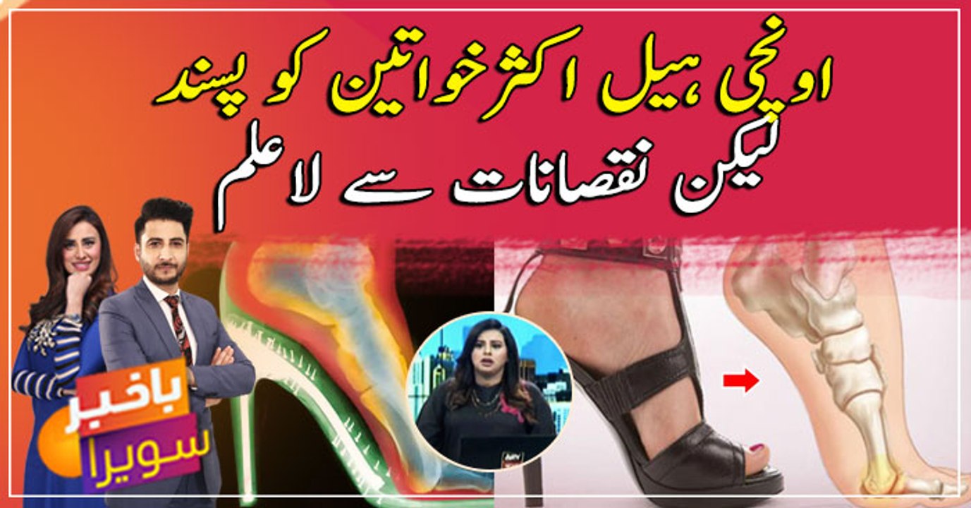 Stylish or Scary? Shocking side effects of wearing "High Heels", Must Watch