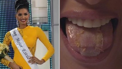 Le secret de minceur de cette femme est terrifiant. Vous allez être choqué