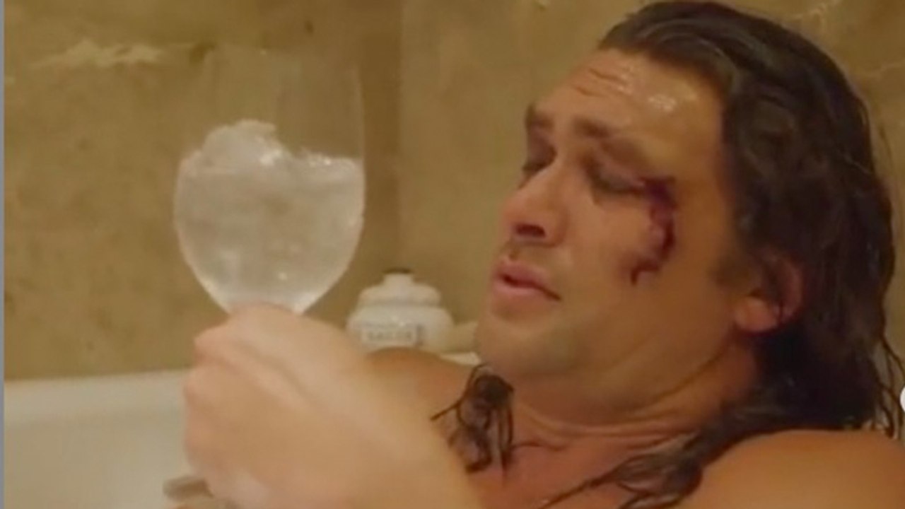 'Game of Thrones'-Star setzt seine Fäuste gegen Plastik ein und holt sich dabei ein blaues Auge