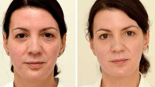 Cette femme a rajeuni de 10 ans grâce à une méthode incroyable. Regardez, le résultat est impressionnant