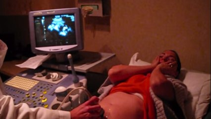 Cette femme enceinte apprend qu'elle attend des jumeaux. Sa réaction ne se fait pas attendre