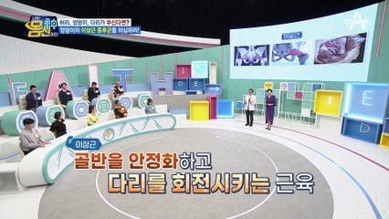 MRI로도 밝혀지지 않는 허리 통증, 치어리더 박기량도 엉덩이 이상근 증후군?!