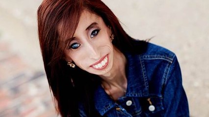 Cette femme est atteinte d'un syndrome extrêmement rare. Mais elle en a fait une force