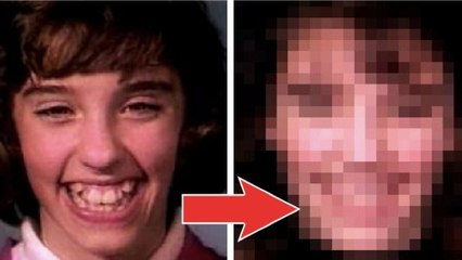 Cette jeune fille a porté un appareil dentaire pendant 18 mois. Et le résultat est extraordinaire !