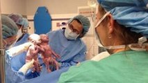 Ces bébés se tenaient la main à la naissance. Six mois plus tard, elles sont toujours inséparables