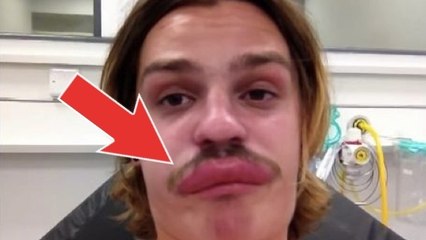 Ce mec a été piqué par un insecte. Mais il ne s'attendait pas à ce qui lui est arrivé ensuite