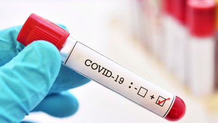 Covid-19: Rekord-Infektionen in der Premier League