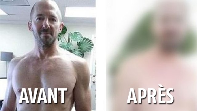 Cet homme a bu 10 canettes de Coca par jour pendant un mois. Le résultat est juste hallucinant !