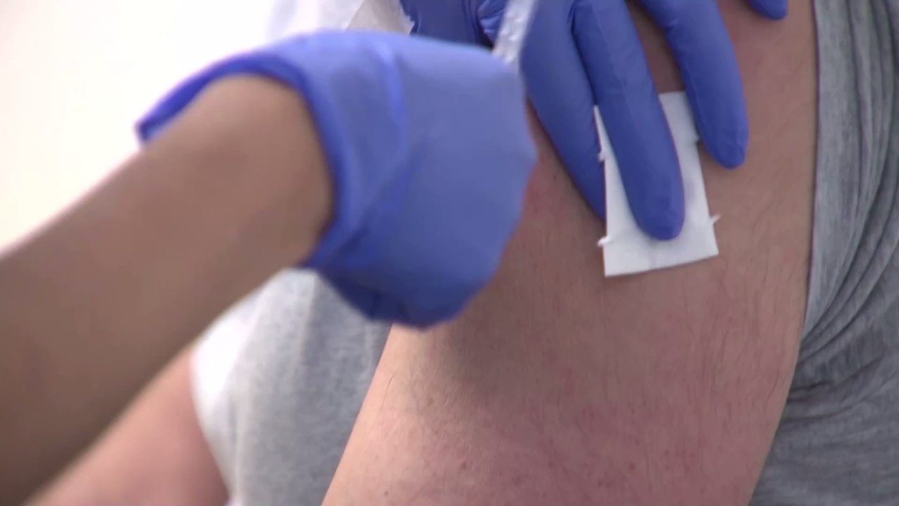 Covid-19: Kurz nach der Impfung löst sich seine Haut ab