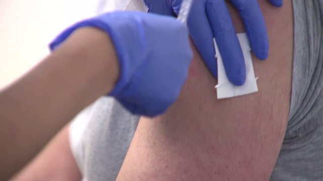 Covid-19: Kurz nach der Impfung löst sich seine Haut ab