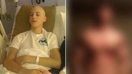 Ce jeune homme était atteint d'un cancer. Mais après avoir guéri, il s'est totalement transformé