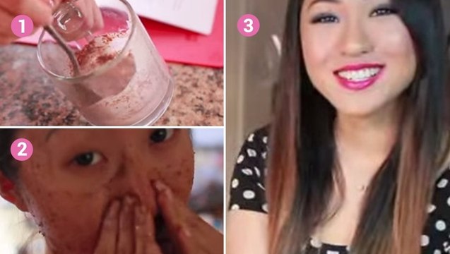 Vous avez des points noirs ? Ces astuces vont vous aider à vous en débarrasser !