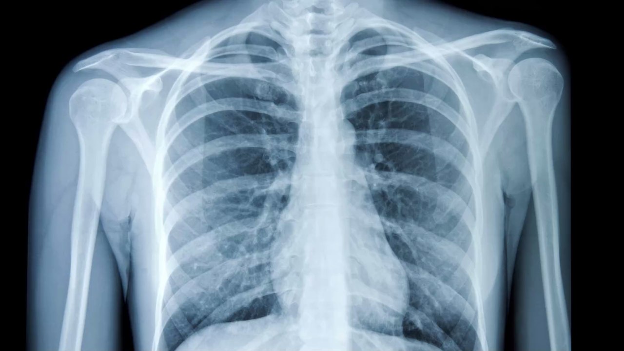 Bei einem Arztbesuch erfährt sie, dass ihr Herz am falschen Fleck sitzt