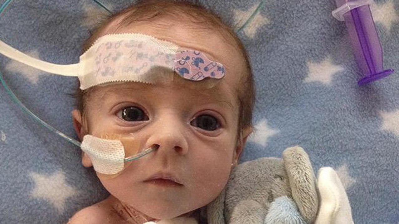 Ce bébé est né avec la moitié du coeur, son histoire est émouvante