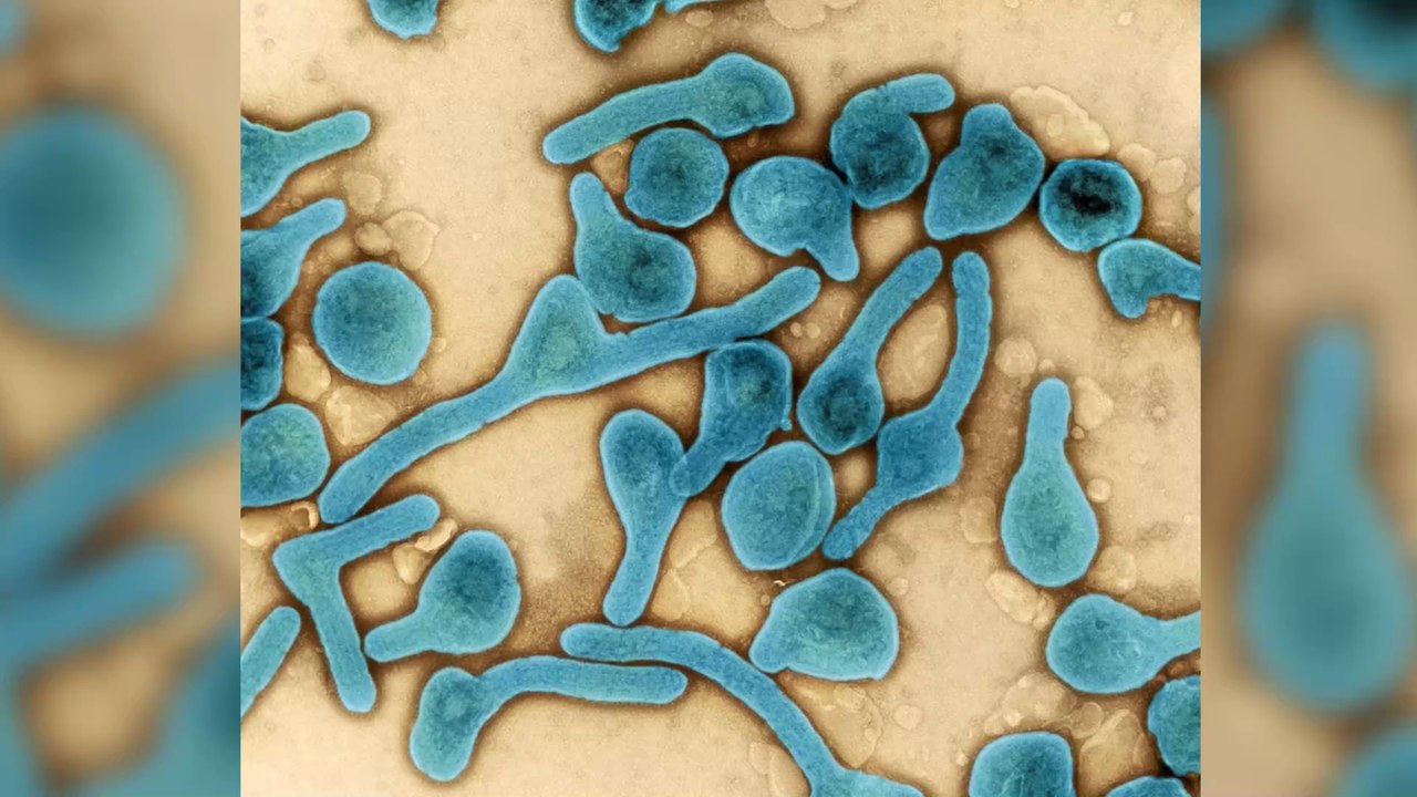 Marburg-Virus: Erster Fall der gefährlichen Erkrankung gemeldet