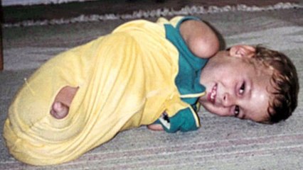 Né sans membres et abandonné par sa mère, il connaît un destin fantastique