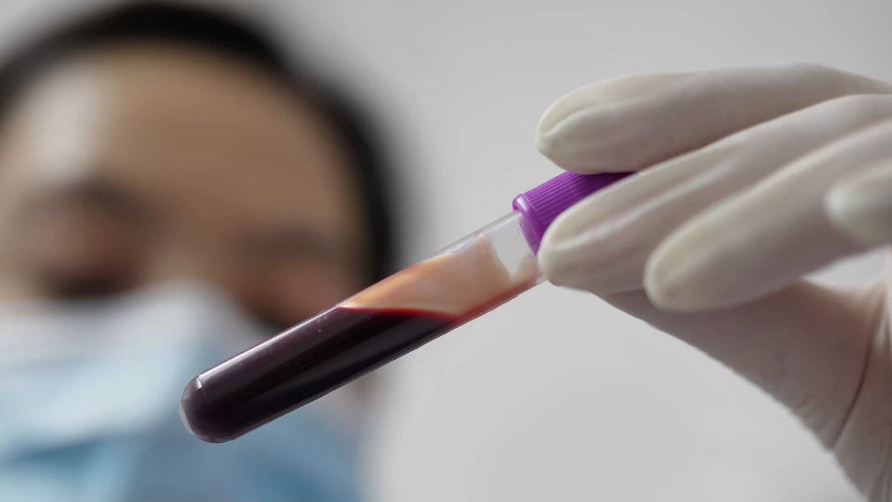 Ein bluttest könnte ausreichen, um eine depression zu diagnostizieren