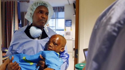 Un petit garçon brûlé est aidé par un homme généreux