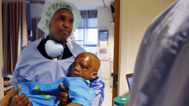 Un petit garçon brûlé est aidé par un homme généreux