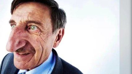 Dieser Mann hat die längste Nase der Welt