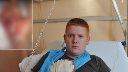 Il fume sa cigarette électronique et elle lui explose dans la main