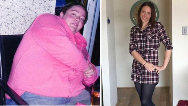 Après avoir perdu près de 100 kilos, elle montre les séquelles de son régime sur son corps
