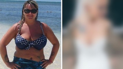 Atteinte d'obésité morbide, elle transforme sa silhouette d'une manière incroyable